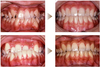 矯正歯科