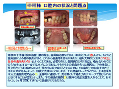 綿密な治療計画